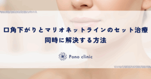 口角下がりとマリオネットラインのセット治療｜同時に解決する方法