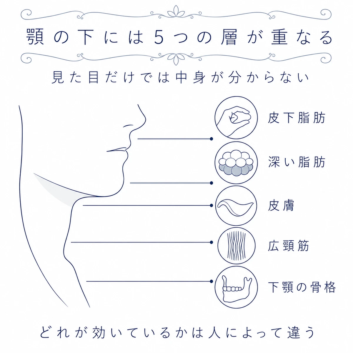 顎下の横顔から皮下脂肪、深い脂肪、皮膚、広頸筋、下顎の骨格へ引き出し線を伸ばした図解