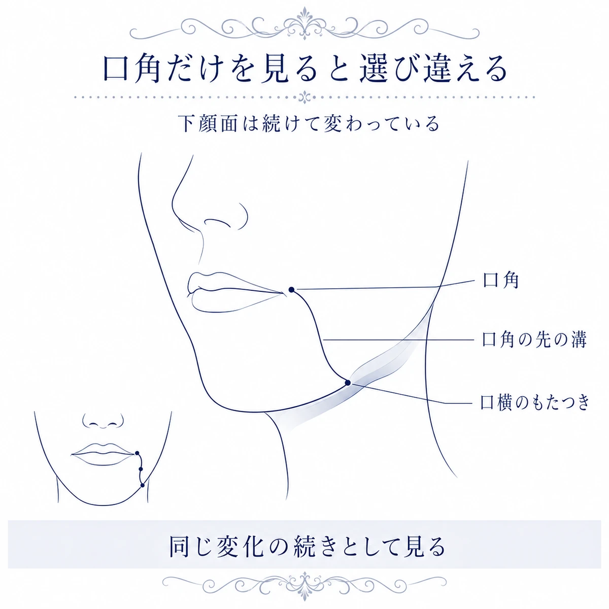 口角からその先の溝、口横のもたつきまでが連続している下顔面の図