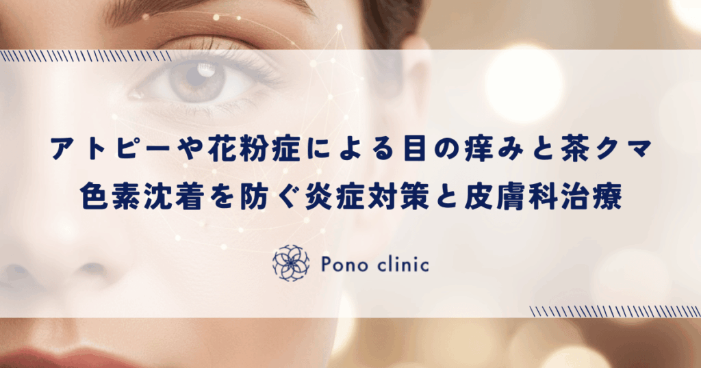 アトピーや花粉症による目の痒みと茶クマ｜色素沈着を防ぐ炎症対策と皮膚科治療
