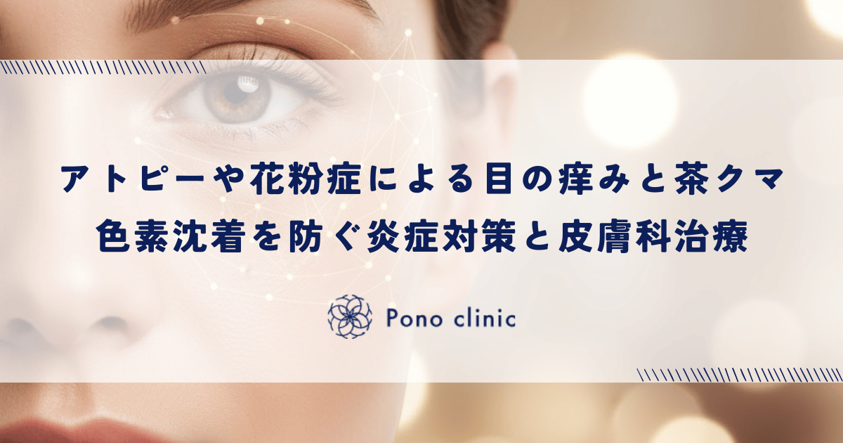 アトピーや花粉症による目の痒みと茶クマ｜色素沈着を防ぐ炎症対策と皮膚科治療