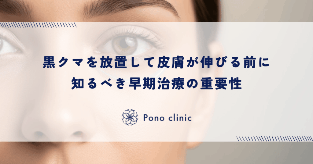 黒クマを放置して皮膚が伸びる前に知るべき早期治療の重要性