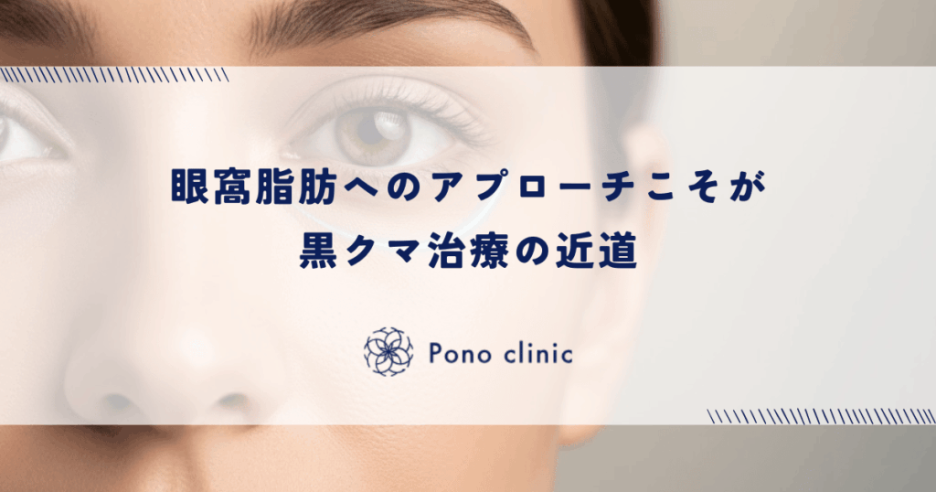 眼窩脂肪へのアプローチこそが黒クマ治療の近道｜保存療法との決定的な違い