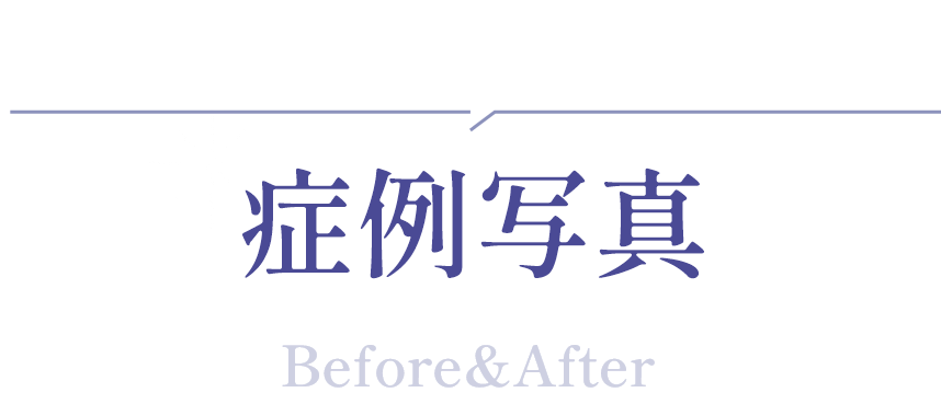 症例写真