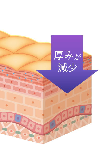 厚みが減少