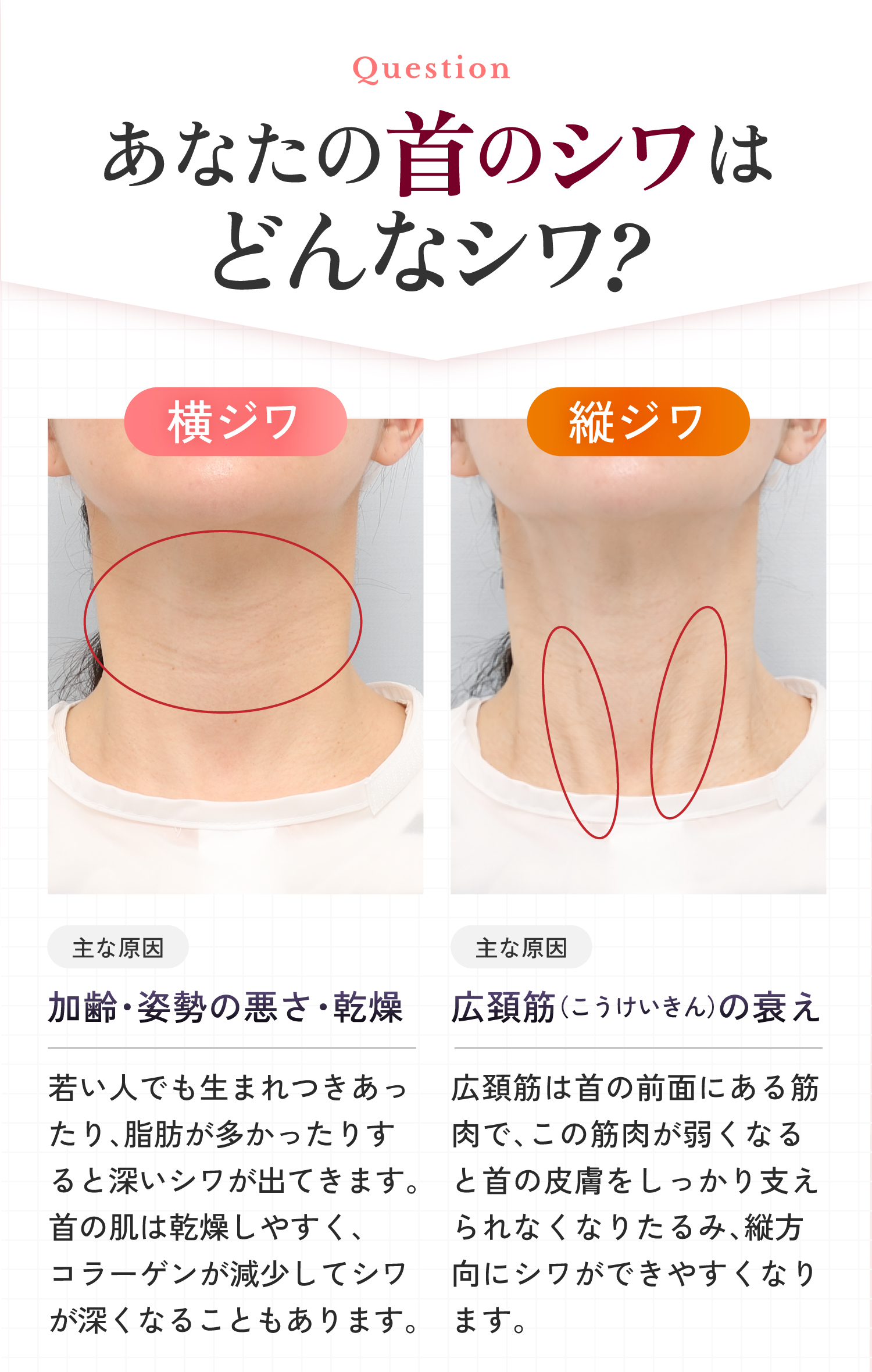 横ジワ 縦ジワ