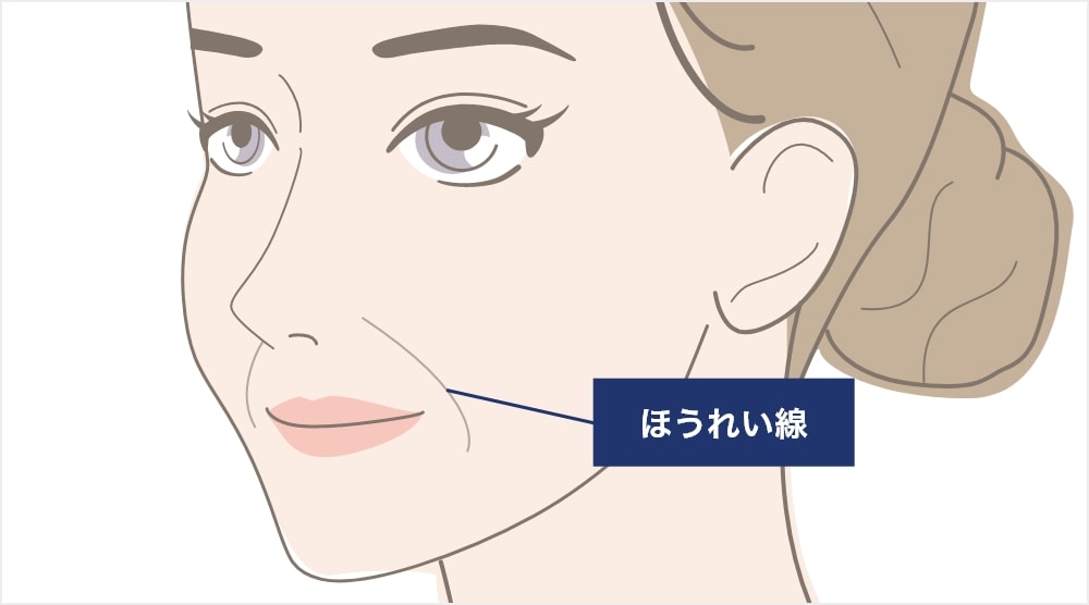 ほうれい線ができる原因