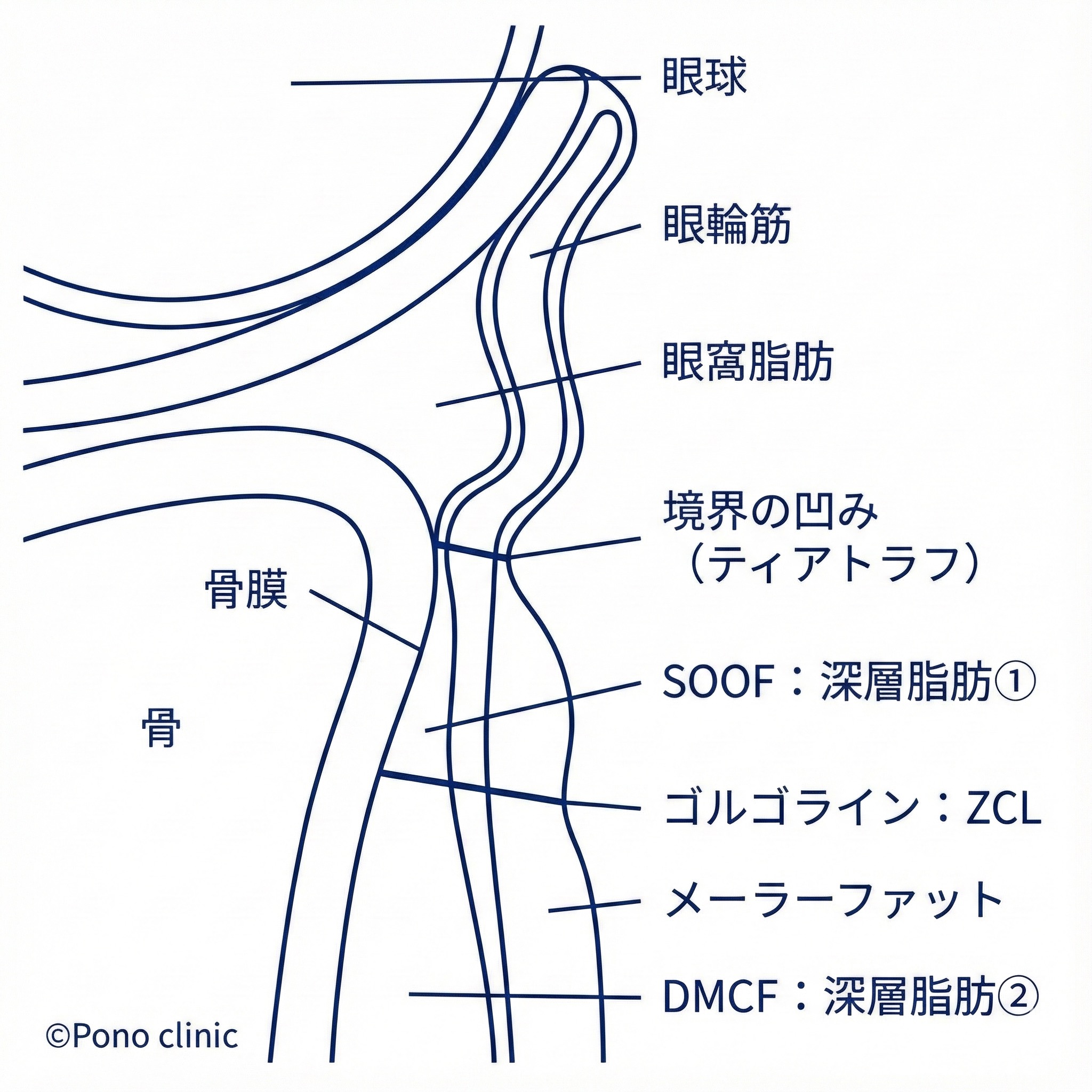 脱脂で変えられるのは眼窩脂肪の前方突出のみ／段差・頬の位置は別問題②