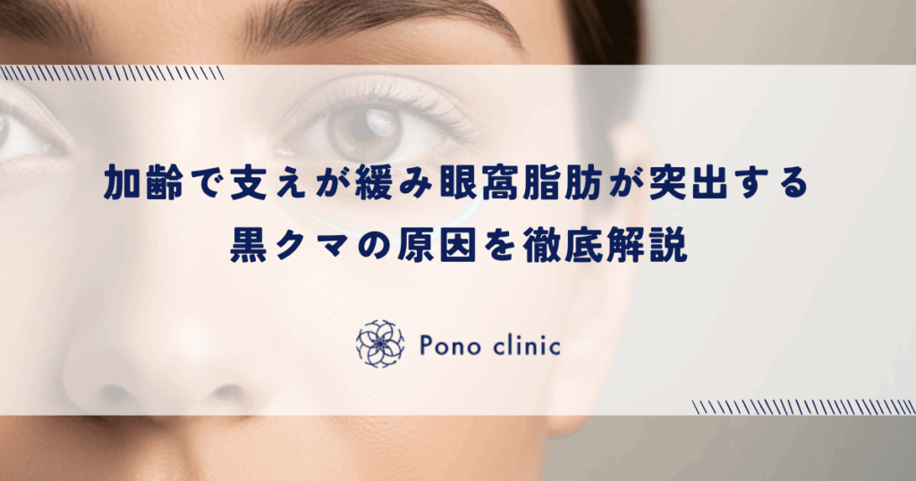 加齢で支えが緩み眼窩脂肪が突出する黒クマの原因を徹底解説