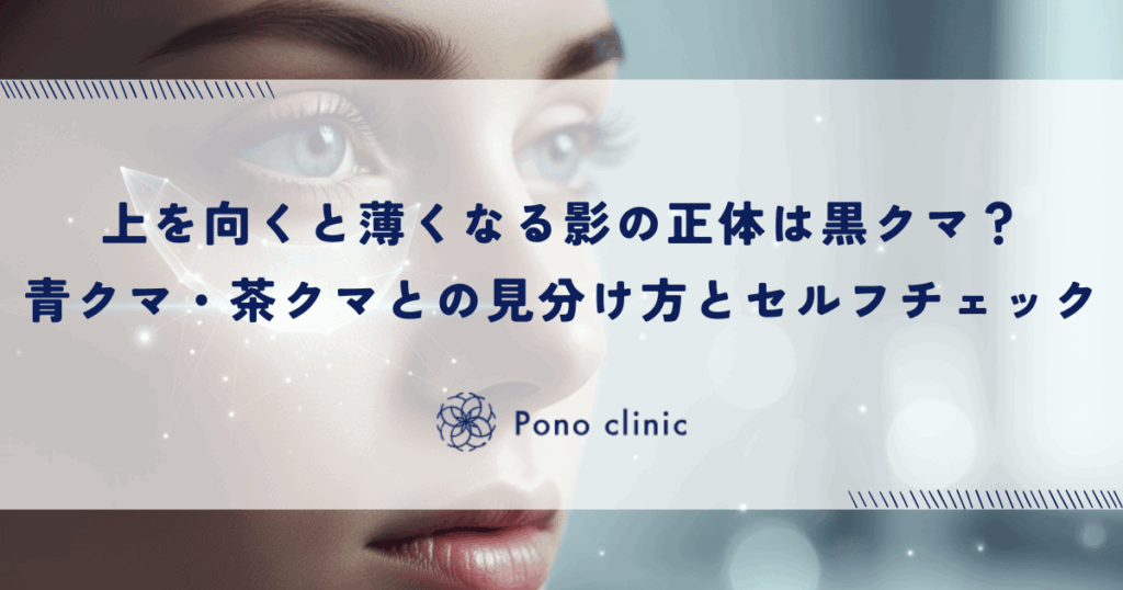 上を向くと薄くなる影の正体は黒クマ？青クマ・茶クマとの見分け方とセルフチェック