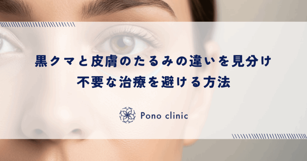 黒クマと皮膚のたるみの違いを見分け不要な治療を避ける方法