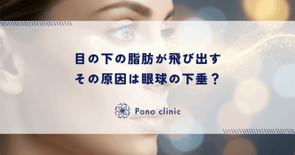 目の下の脂肪が飛び出す原因は眼球の下垂？ロックウッド靭帯の緩みとヘルニアの仕組み
