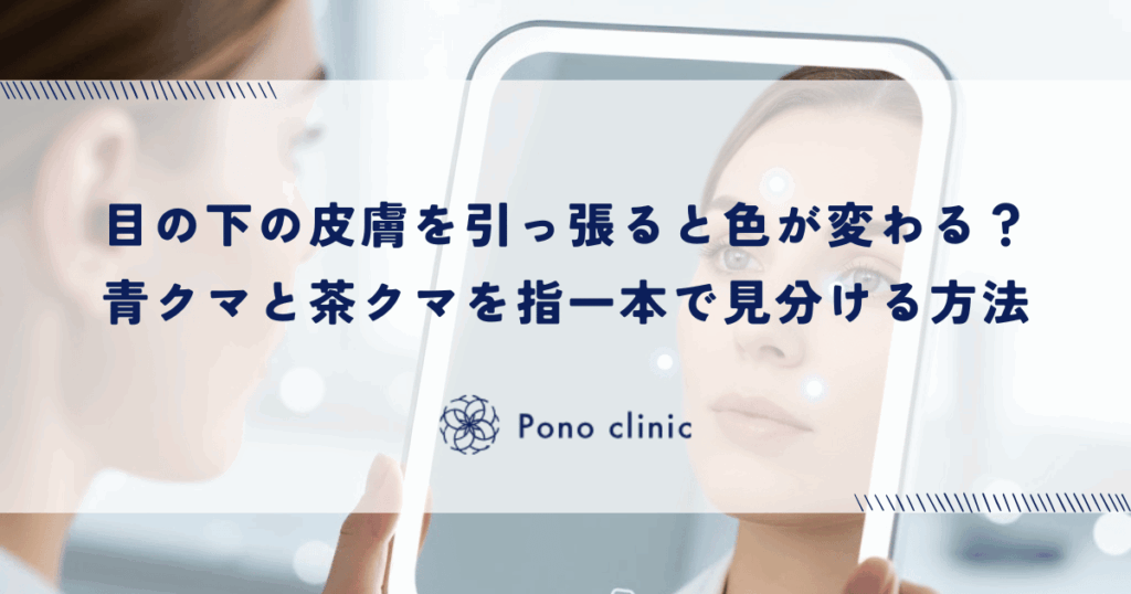 目の下の皮膚を引っ張ると色が変わる？「青クマ」と「茶クマ」を指一本で確実に見分ける方法