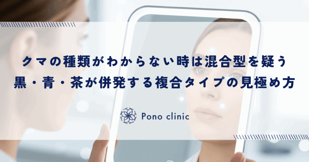 自分のクマの種類がわからない時は「混合型」を疑う｜黒・青・茶が併発する複合タイプの見極め方