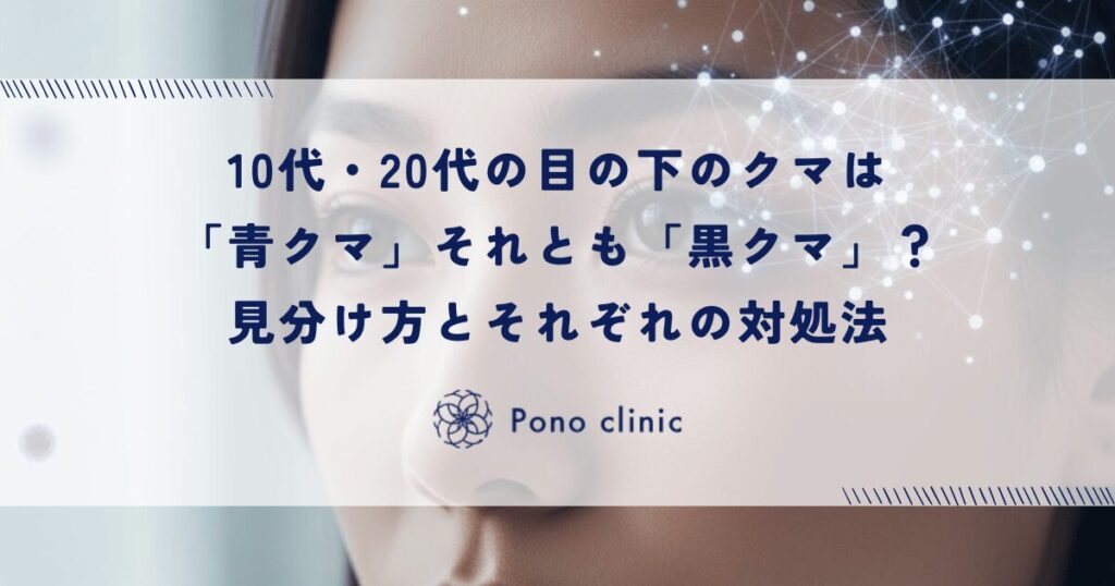 10代・20代の目の下のクマは「青クマ」それとも「黒クマ」？見分け方とそれぞれの対処法