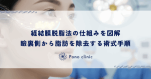 経結膜脱脂法（切らない目の下の脱脂）の仕組みを図解｜瞼の裏側から脂肪を除去する術式の手順