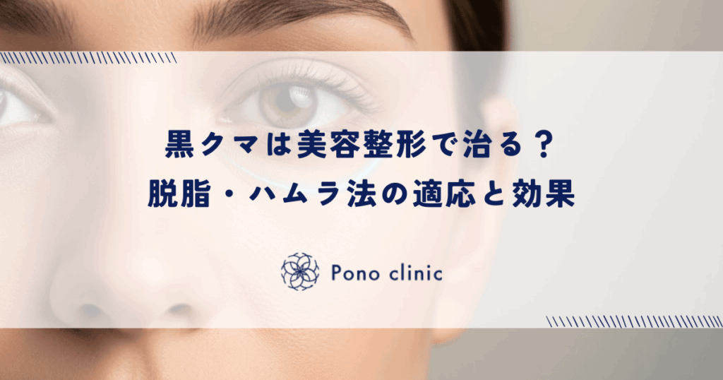 黒クマは美容整形で治る？脱脂・ハムラ法の適応と効果