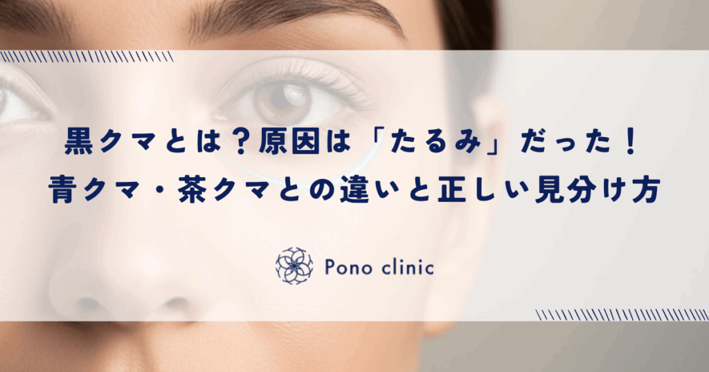 黒クマとは？原因は「たるみ」だった！青クマ・茶クマとの違いと正しい見分け方
