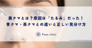 黒クマとは？原因は「たるみ」だった！青クマ・茶クマとの違いと正しい見分け方