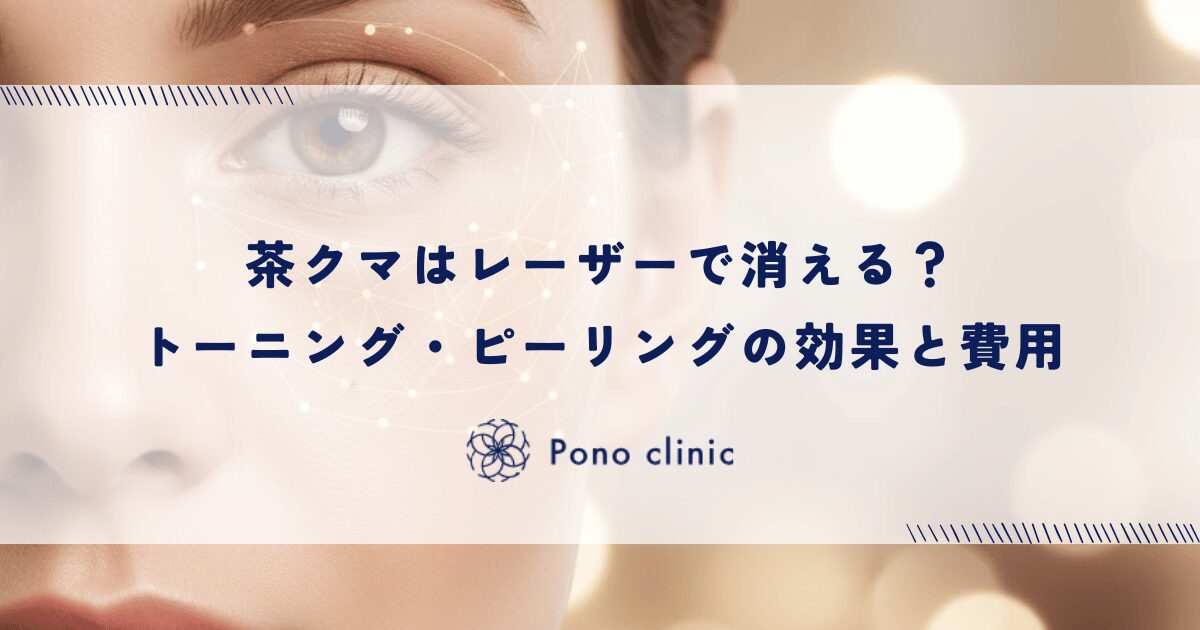 茶クマはレーザーで消える？トーニング・ピーリングの効果と費用
