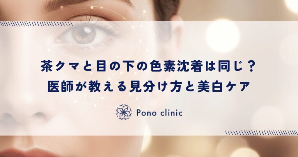 茶クマと目の下の色素沈着は同じ？医師が教える見分け方と美白ケア