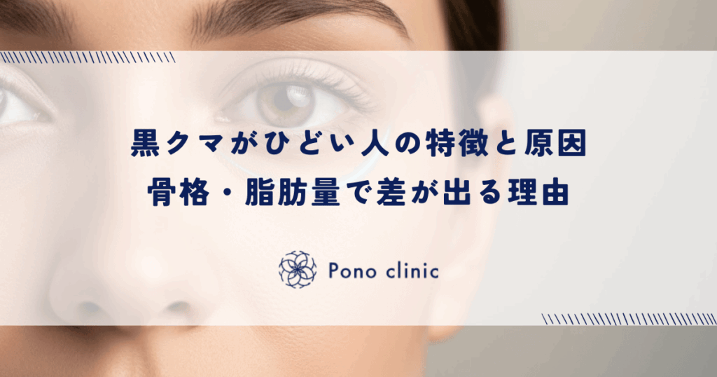 黒クマがひどい人の特徴と原因｜骨格・脂肪量で差が出る理由