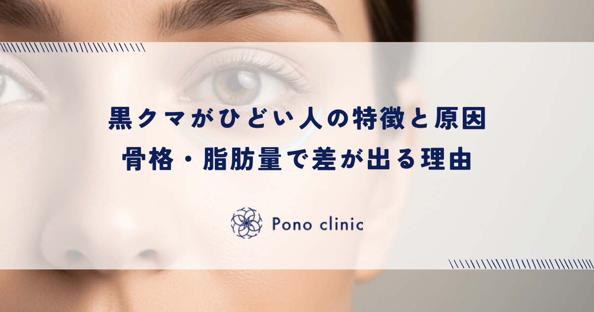 黒クマがひどい人の特徴と原因｜骨格・脂肪量で差が出る理由