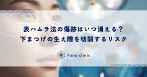 表ハムラ法の傷跡はいつ消える？下まつげの生え際を切開するリスクと目立たなくなるまでの期間