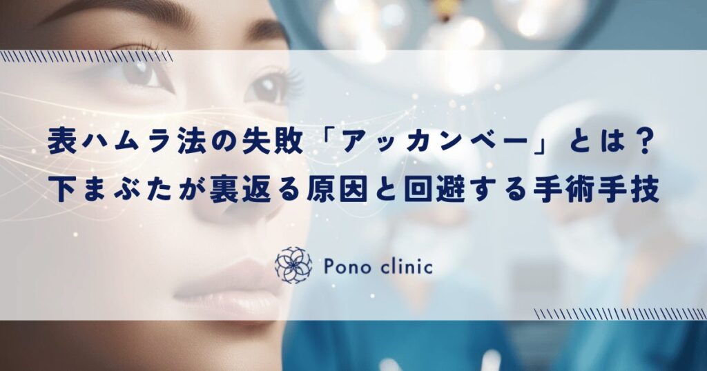 表ハムラ法の失敗「アッカンベー（外反）」とは？下まぶたが裏返る原因と回避する手術手技