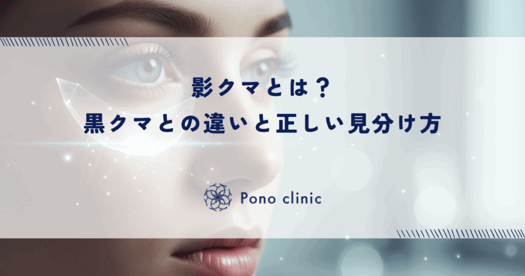 影クマとは？黒クマとの違いと正しい見分け方