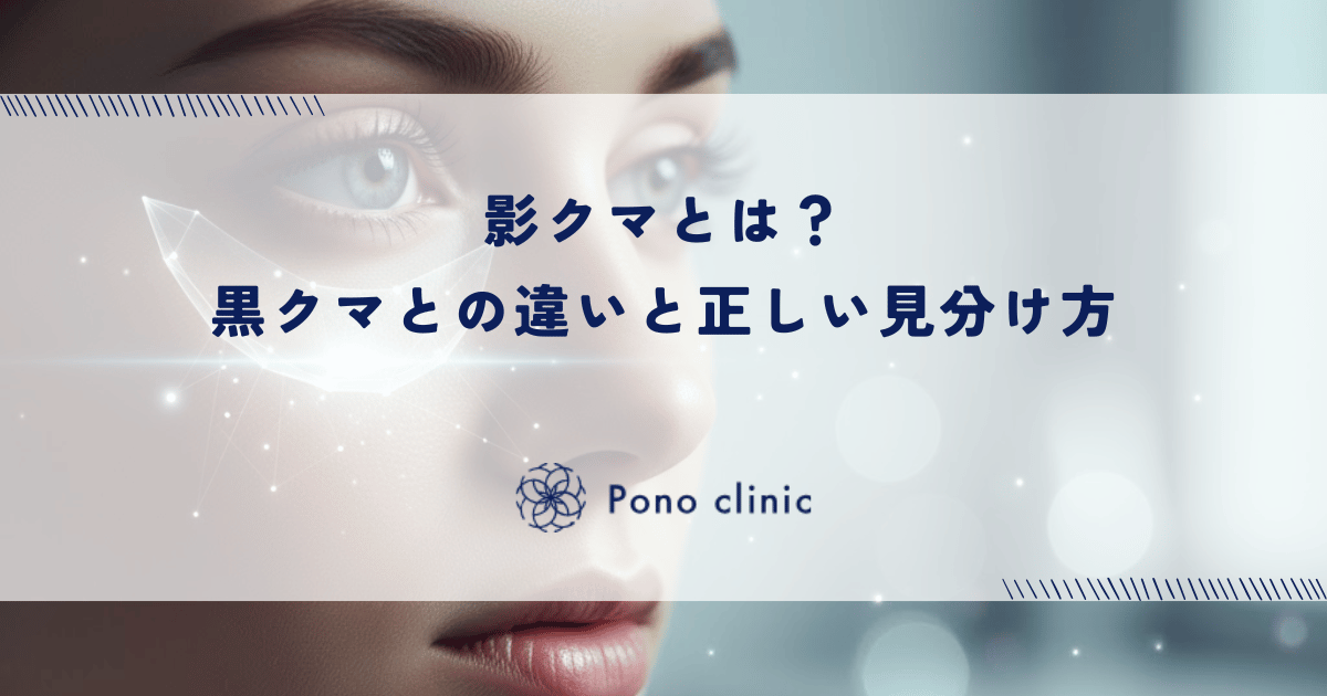 影クマとは？黒クマとの違いと正しい見分け方
