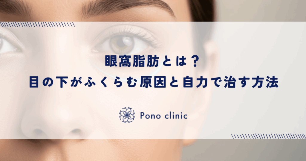 眼窩脂肪とは？目の下がふくらむ原因と自力で治す方法