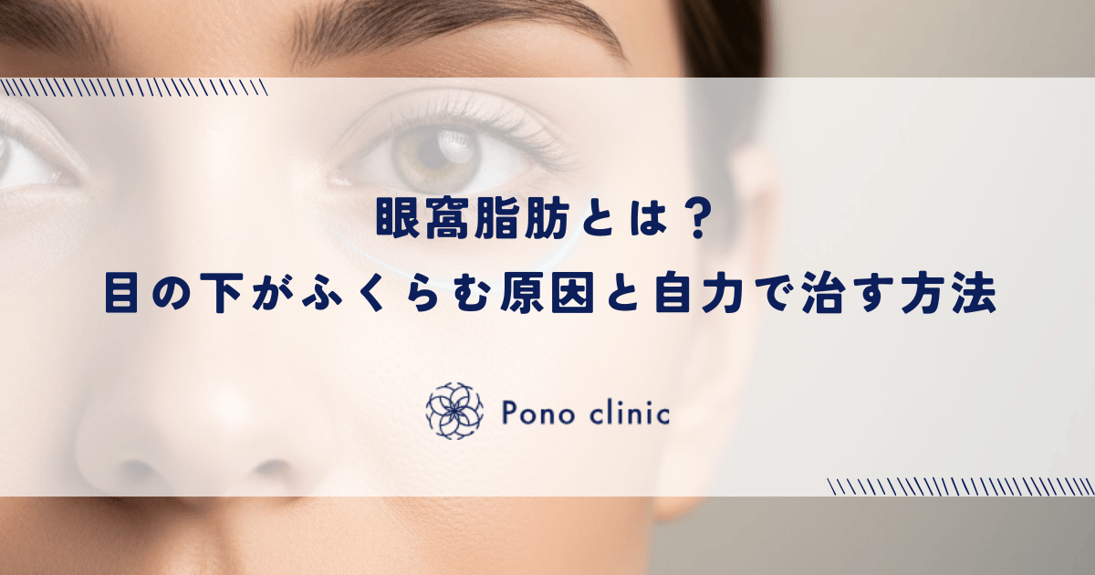 眼窩脂肪とは？目の下がふくらむ原因と自力で治す方法
