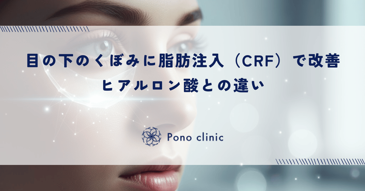 目の下のくぼみに脂肪注入（CRF）で改善｜ヒアルロン酸との違い