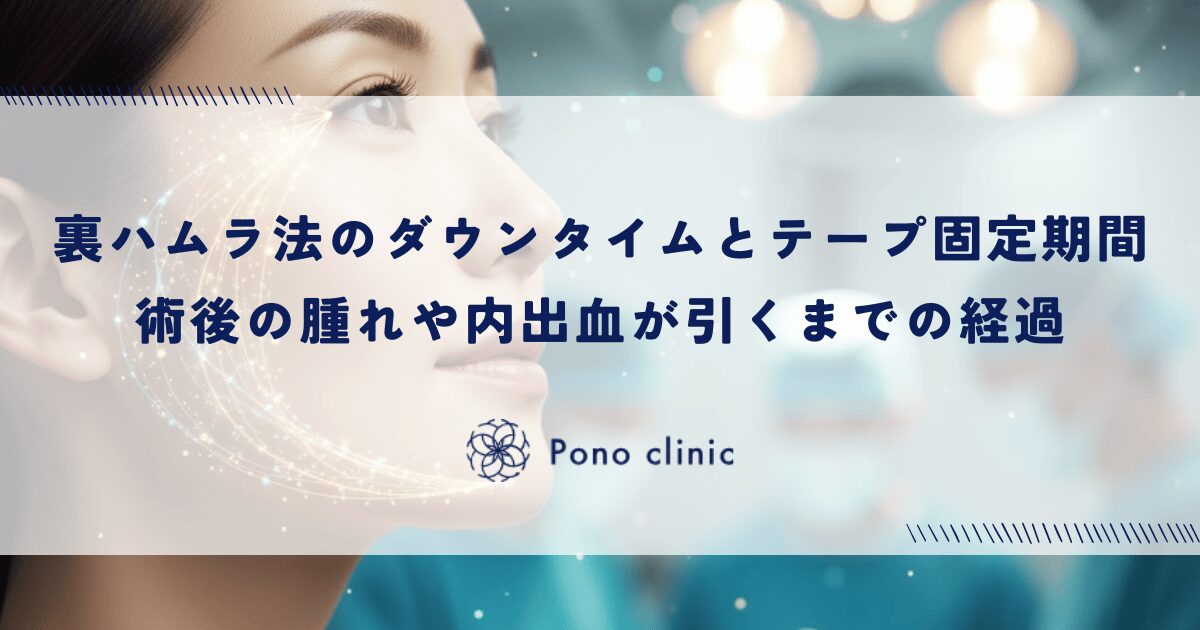 裏ハムラ法のダウンタイムとテープ固定期間｜術後の腫れや内出血が引くまでの経過