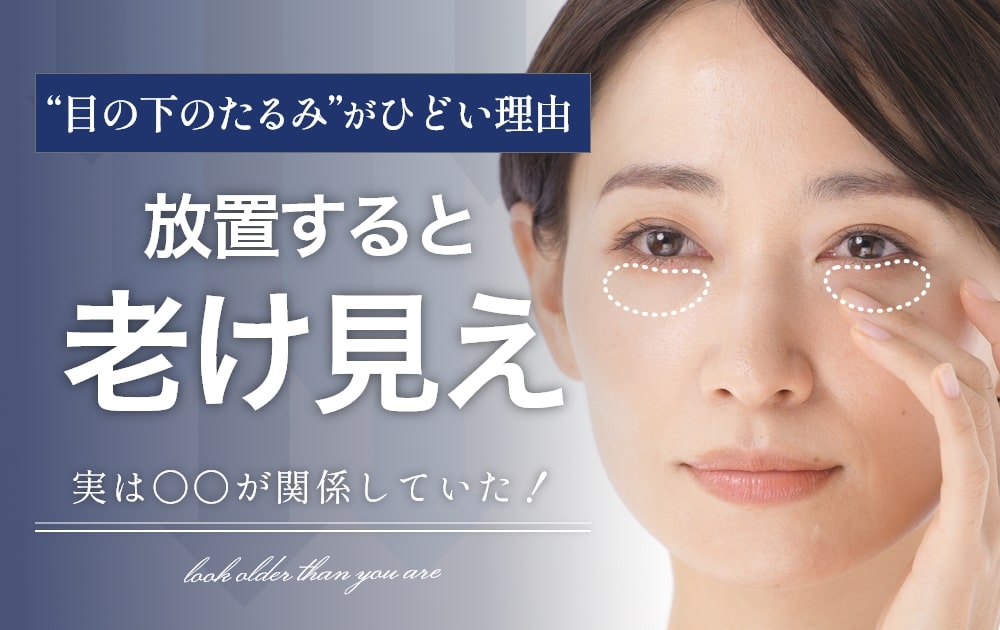 目の下のたるみがひどい理由