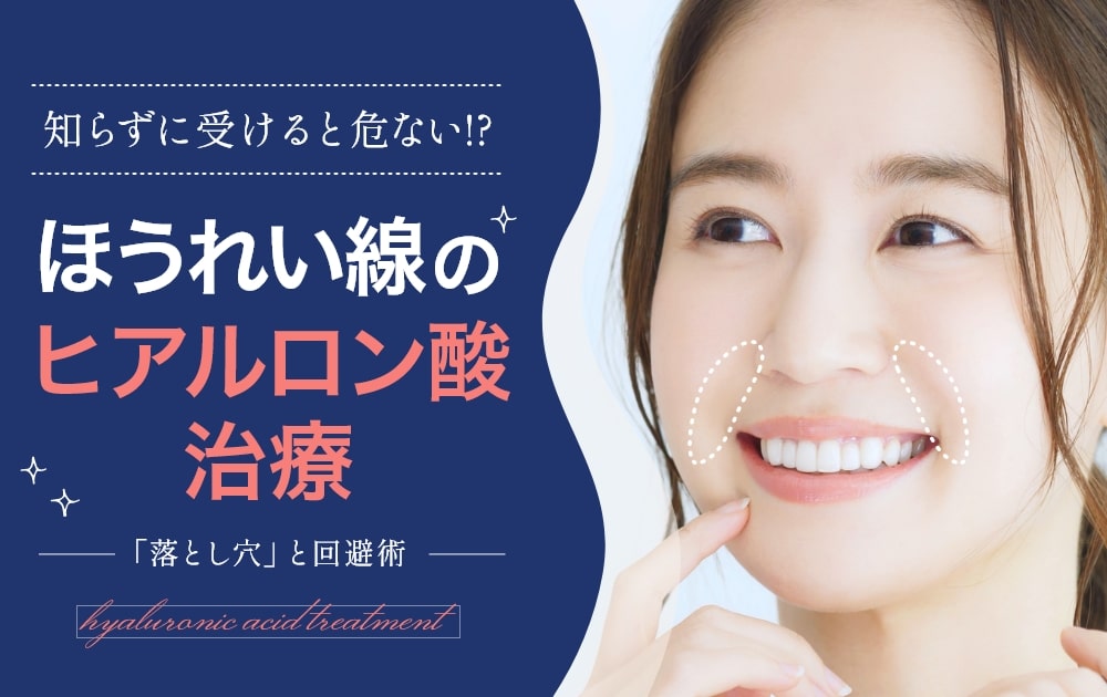 ほうれい線のヒアルロン酸治療