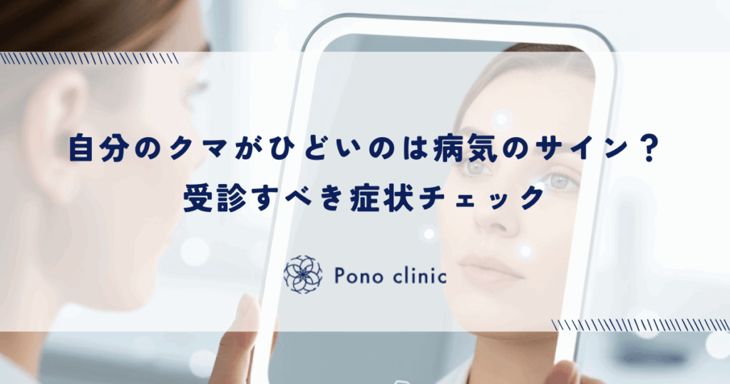 自分のクマがひどいのは病気のサイン？受診すべき症状チェック