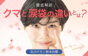 クマと涙袋の違い