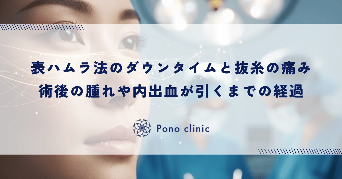表ハムラ法のダウンタイムと抜糸の痛み｜術後の腫れや内出血が引くまでの経過と仕事復帰