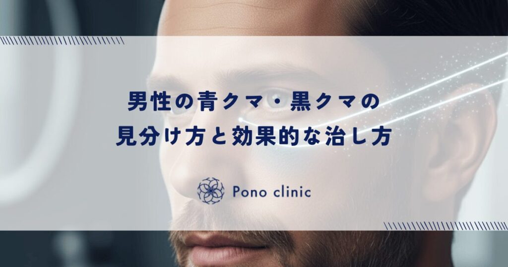 男性の青クマ・黒クマの見分け方と効果的な治し方