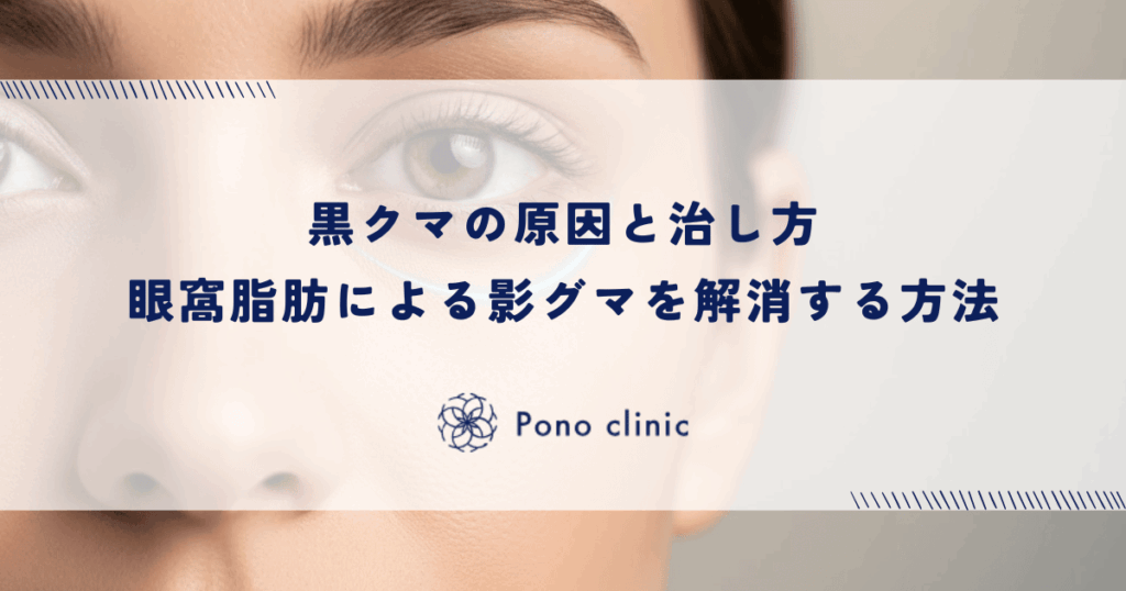 黒クマの原因と治し方|眼窩脂肪による影グマを解消する方法