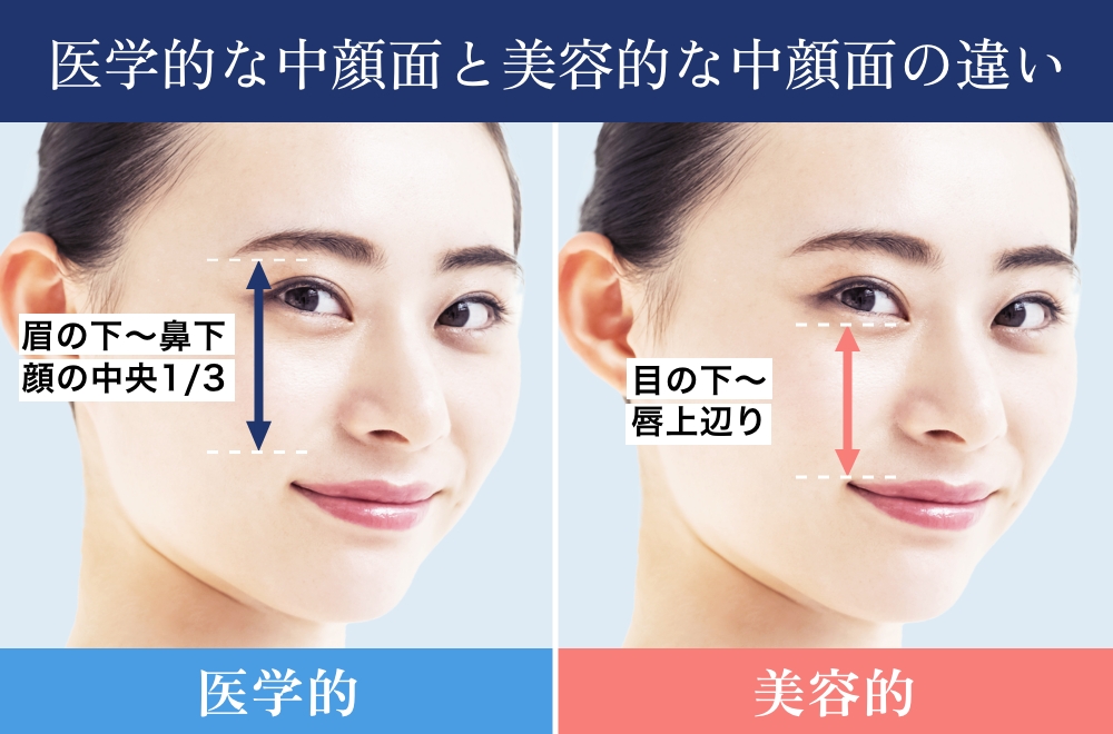中顔面とはどこの範囲かを示した図