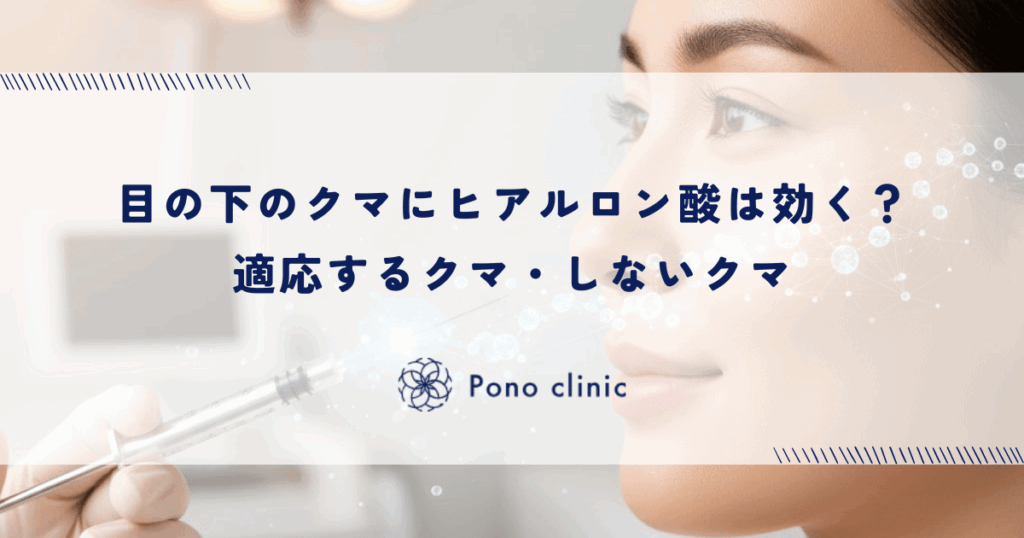 目の下のクマにヒアルロン酸は効く？適応するクマ・しないクマ