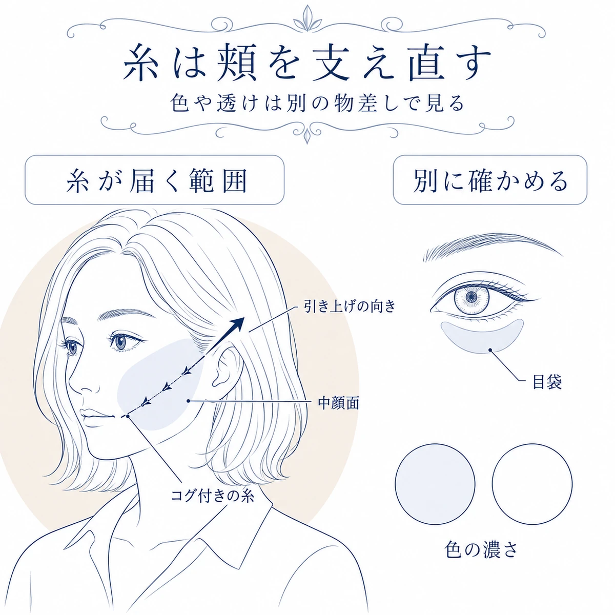 頬の皮下に通したコグ付きの糸が中顔面をこめかみ側へ引き上げる位置を示した図