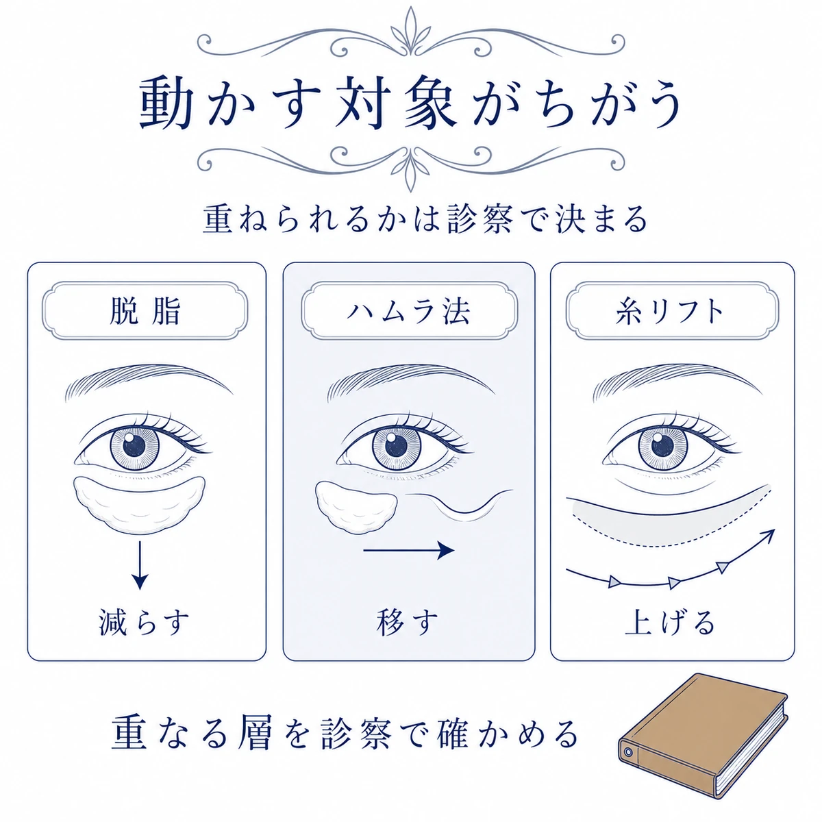 脱脂は脂肪を減らし、ハムラ法は脂肪を移し、糸リフトは頬を引き上げる違いの比較図