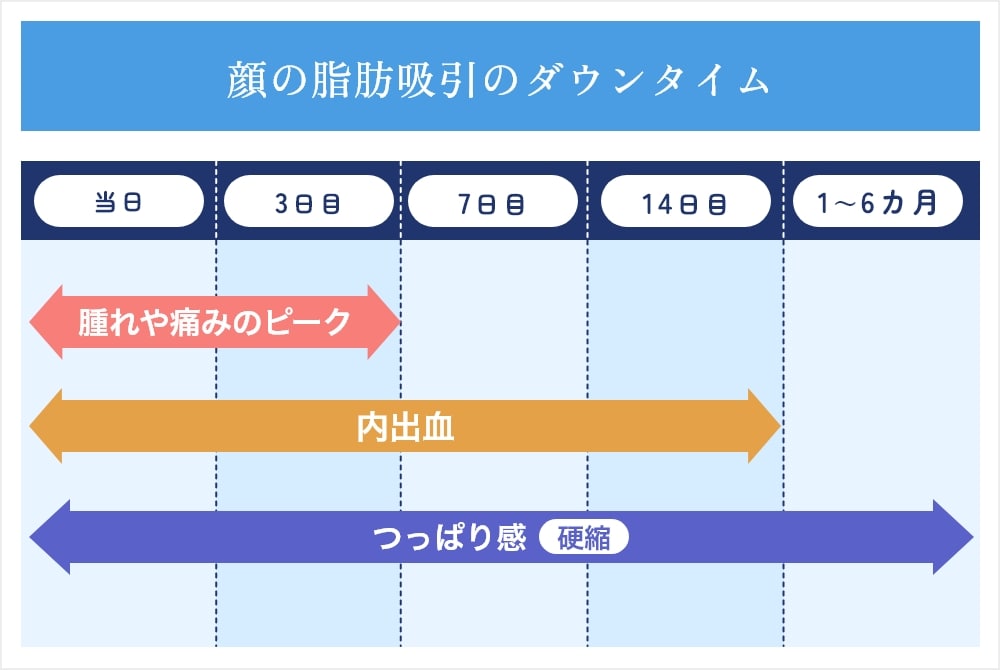 顔の脂肪吸引のダウンタイム