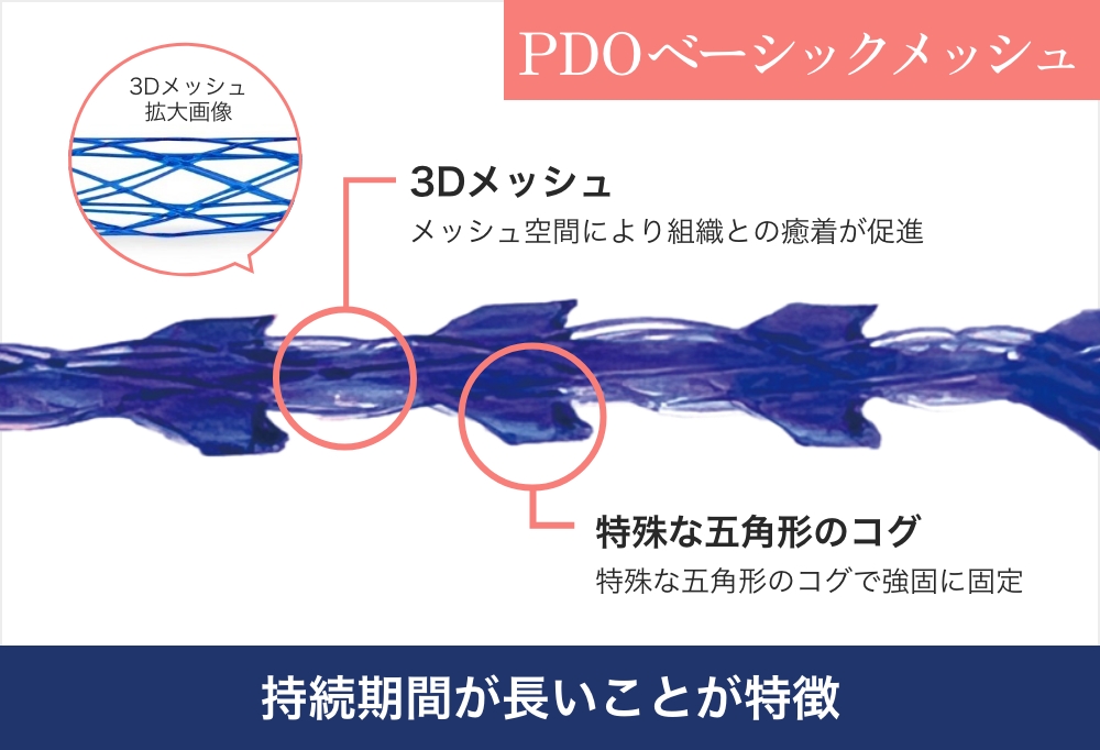 Ponoスレッドリフト（糸リフト） - 新宿の美容外科・美容皮膚科
