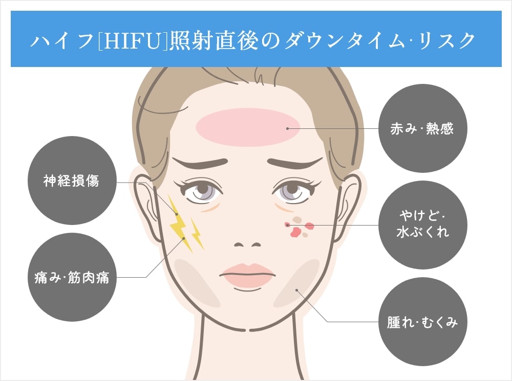 ハイフ（HIFU）照射直後のダウンタイム・リスク