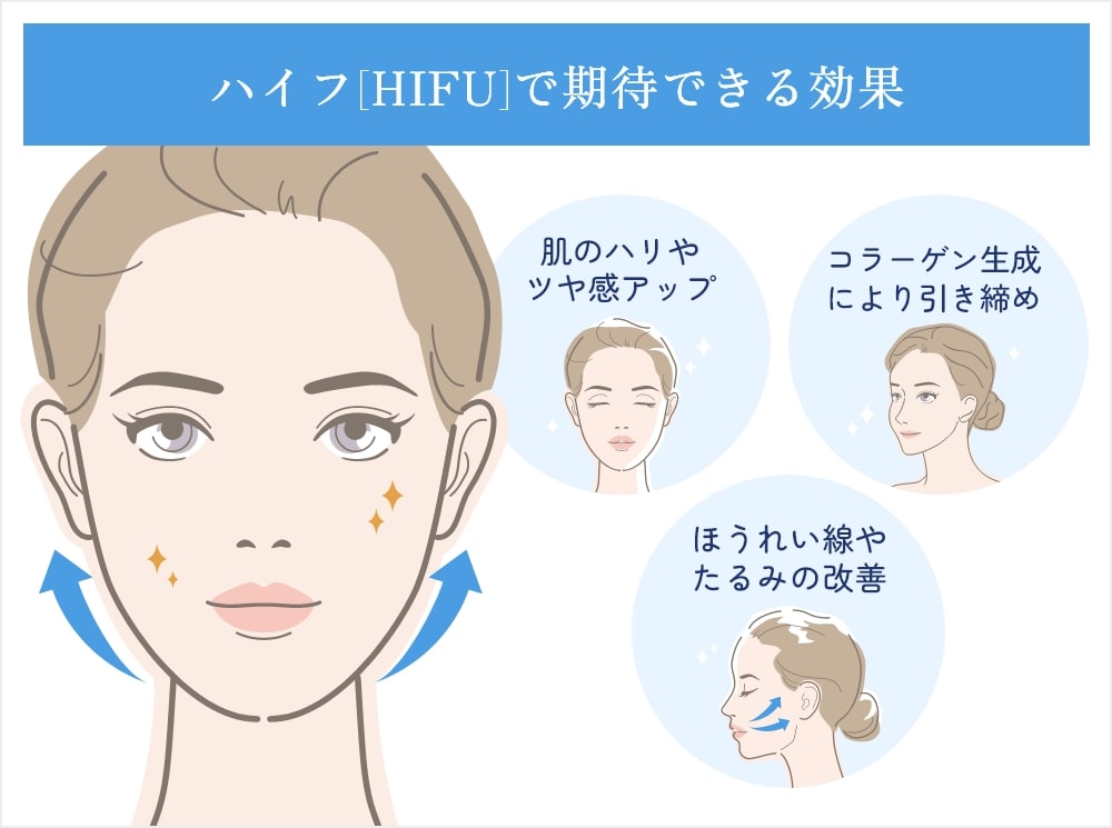 ハイフ（HIFU）で期待できる効果